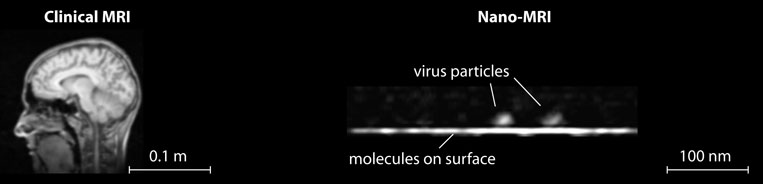 Nano-MRI title image